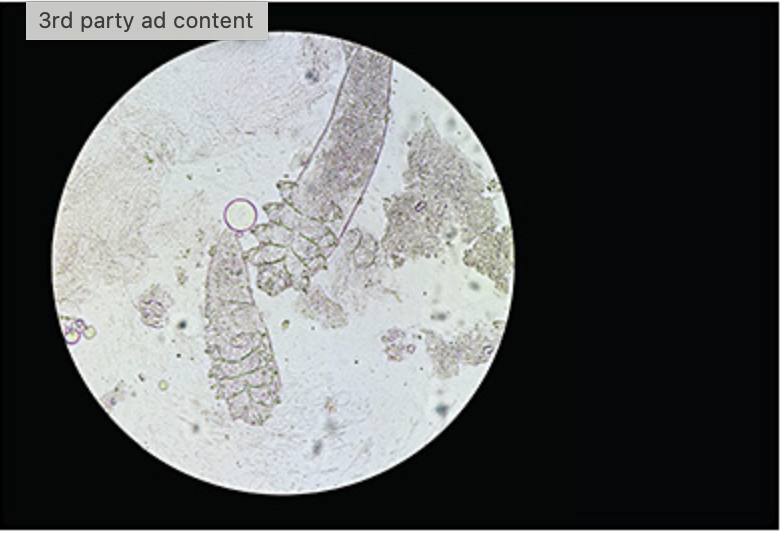 Research Article Spotlight | Corneal Physician