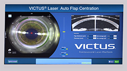 VICTUS® Laser Auto Flap Centration